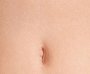 Abdominoplastia Abdominoplastia