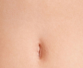 Abdominoplastia