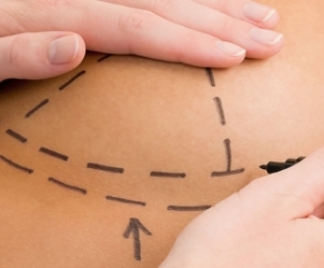 Prótese de Mama Prótese de Mama