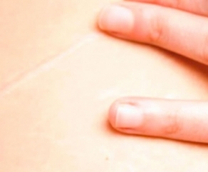 Correção de Cicatrizes Correção de Cicatrizes