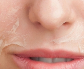 Peeling Facial